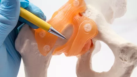 Medical devices provide US$6B opportunity for 3D printing